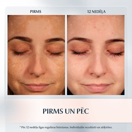 EUCERIN Anti-Pigment Night sejas krēms, 50 ml