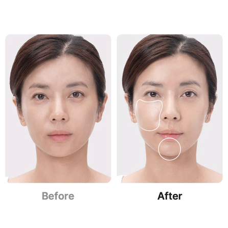 MEDICUBE Age-R Booster Pro Black sejas kopšanas ierīce, 1 gab.