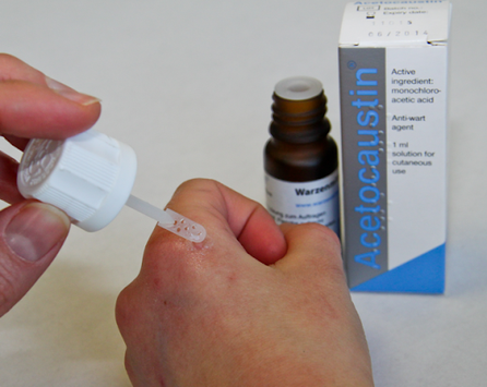 ACETOCAUSTIN LOSUNG šķīdums, 0.5 ml