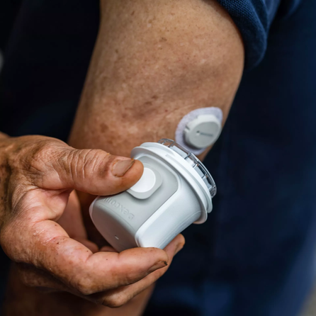 DEXCOM ONE+ Sensor (10 dienām) glikometrs, 1 gab.