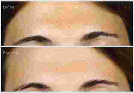 DERMALOGICA Powerbright Dark Spot serums, 30 ml