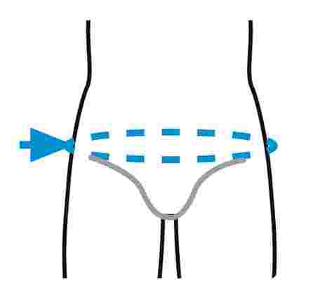 PRIM Spine Care (XXL) PRS610BG Muguras ortoze, 1 gab.
