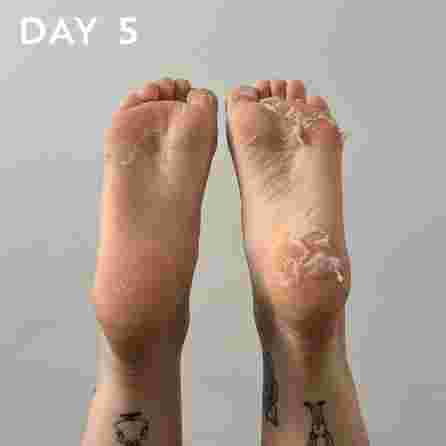 MASKOLOGY  Peeling Foot maska kājām, 1 pāris