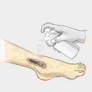 GRANUDACYN sprejs, 250 ml