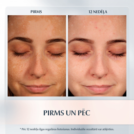 EUCERIN Anti-Pigment Day SPF 30 sejas krēms, 50 ml